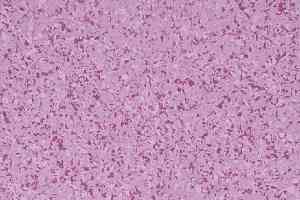 Линолеум Mipolam Affinity 4482 Orchid фото  | FLOORDEALER